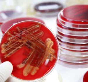 microbiology-lab-services-guide-carousel-6